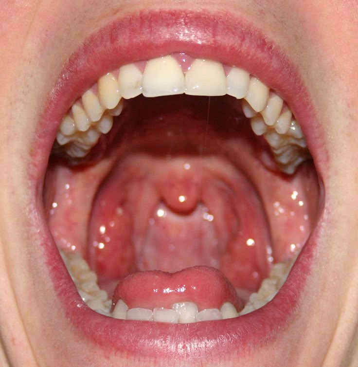 Oral care